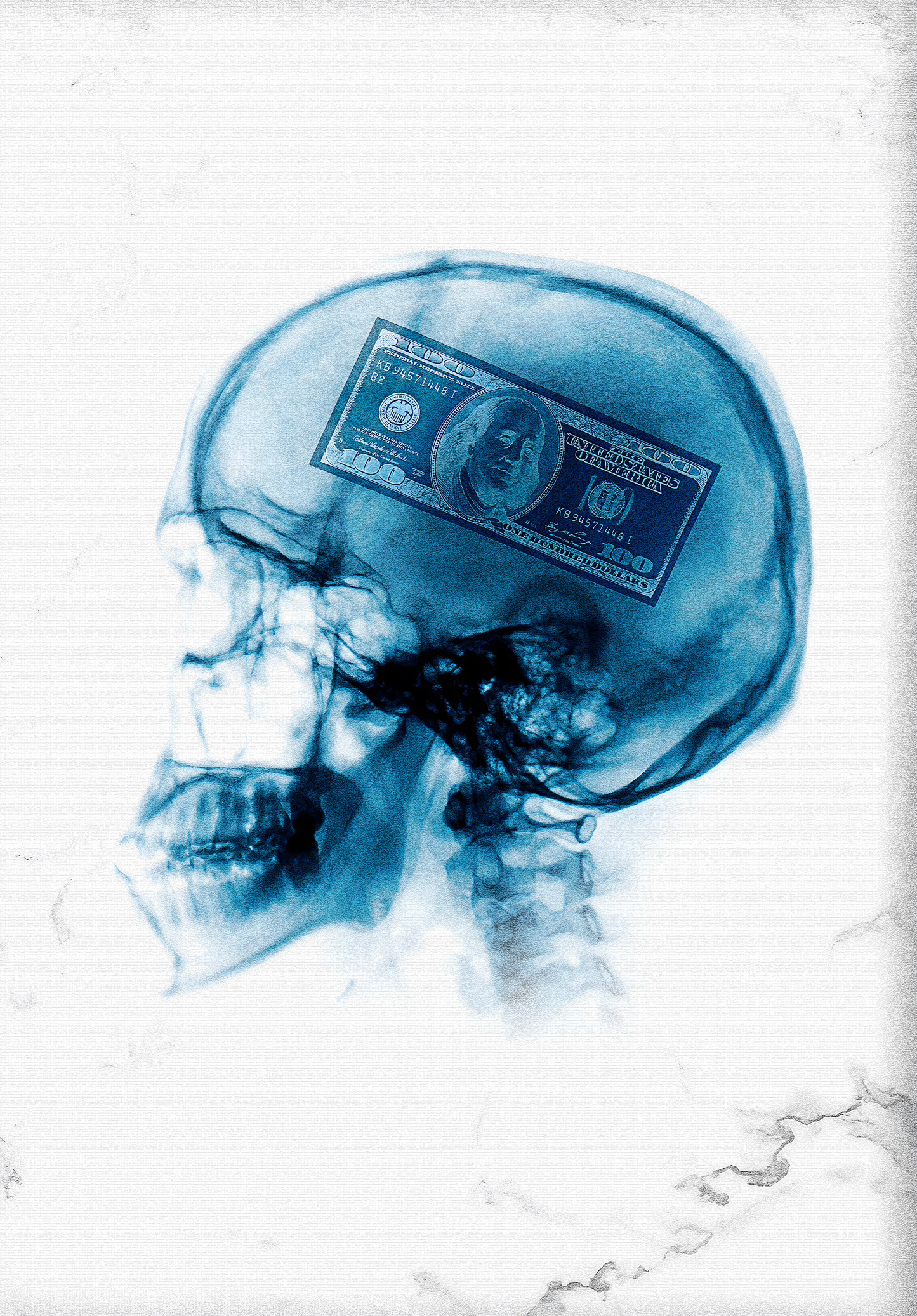X-Ray Art | Human Skull & Dollar | Modern Money Mindset