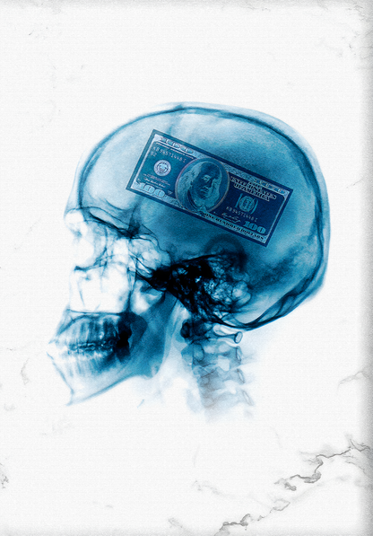 X-Ray Art | Human Skull & Dollar | Modern Money Mindset